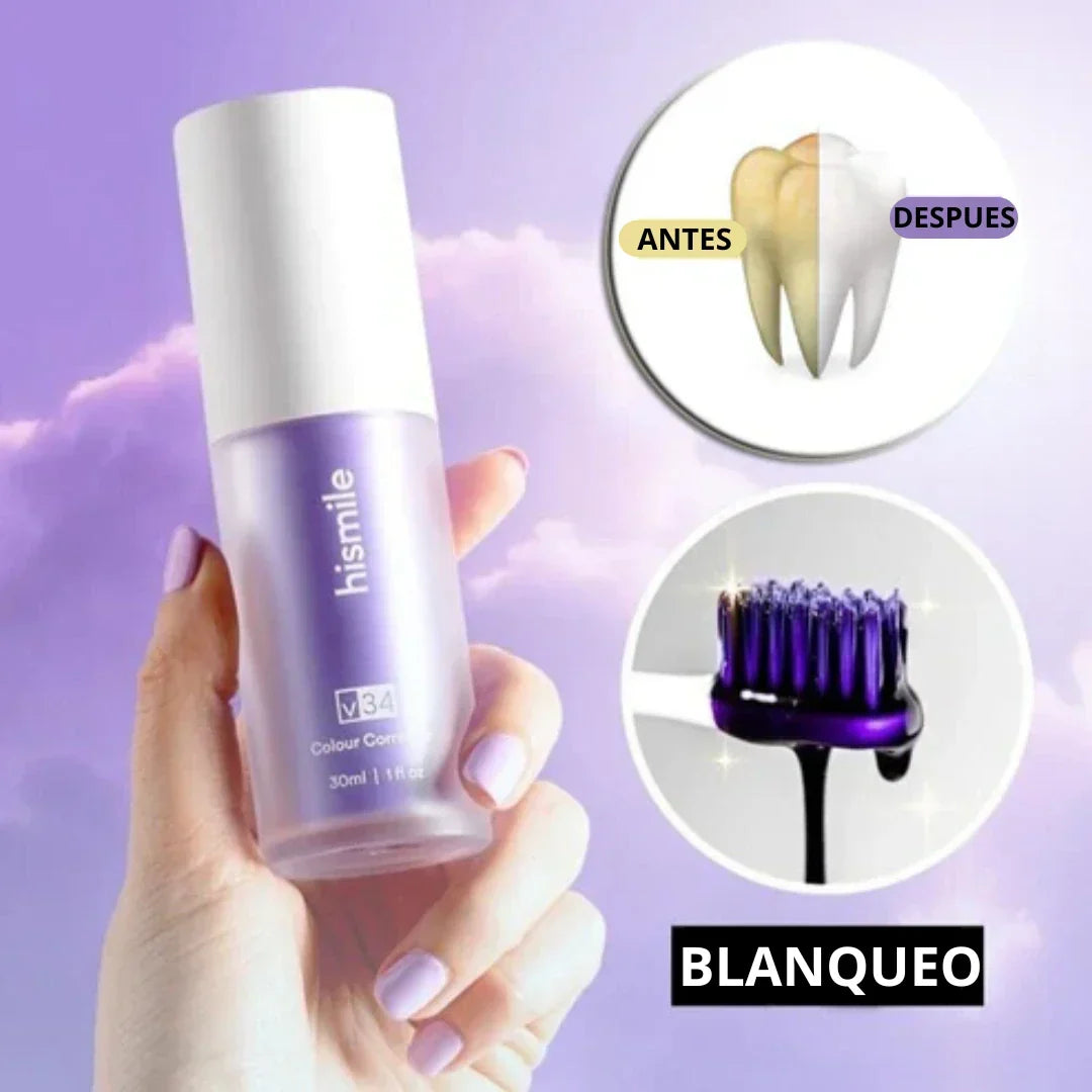 Blanqueamiento dental casero HiSmile®︎🦷🌟